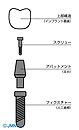 インプラントの構造c