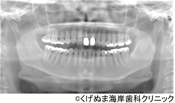 治療前
