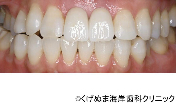 治療後