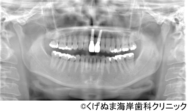 治療後