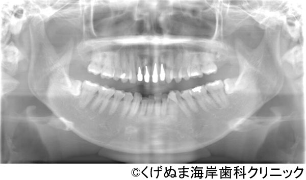 治療前