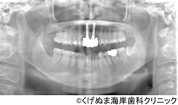 治療後