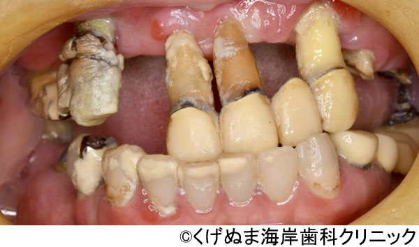 治療前