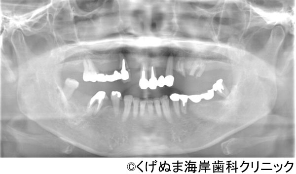 治療前