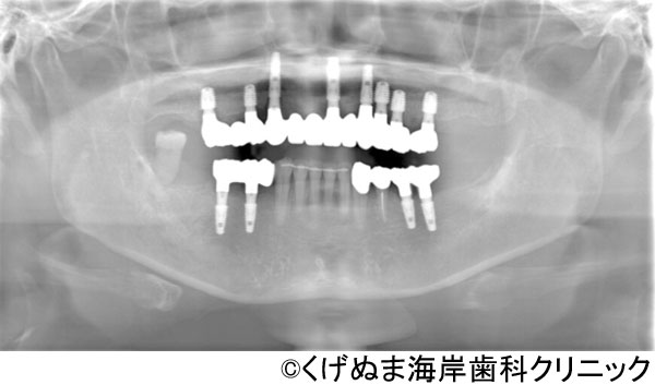 治療後
