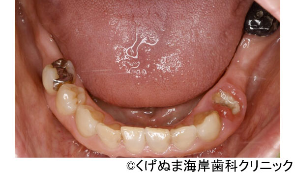 治療前