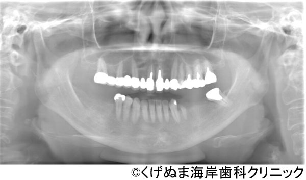 治療前