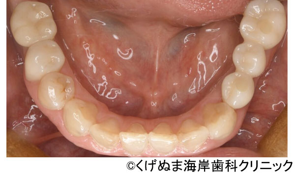治療後