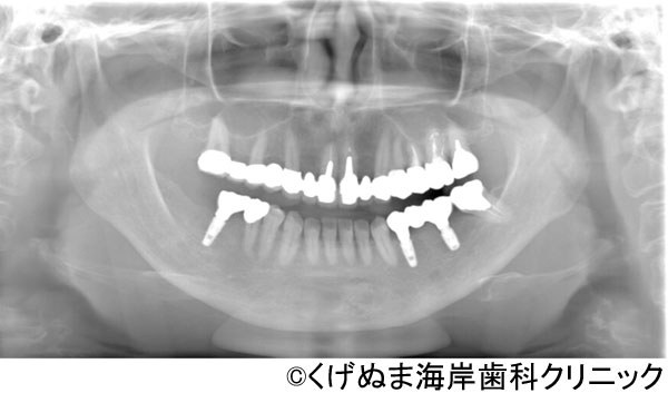 治療後