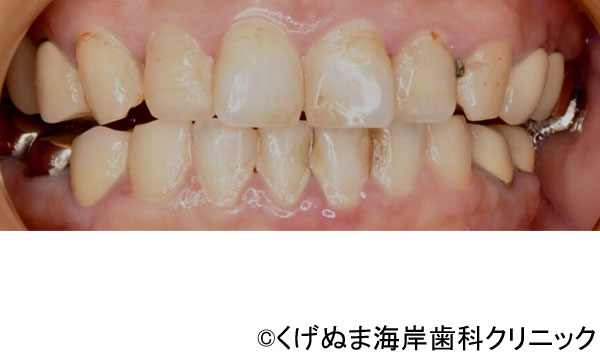 治療前