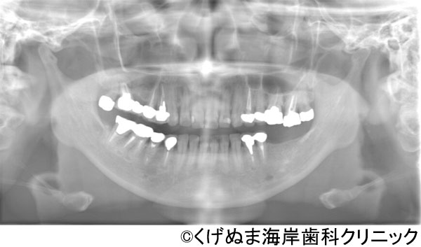 治療前