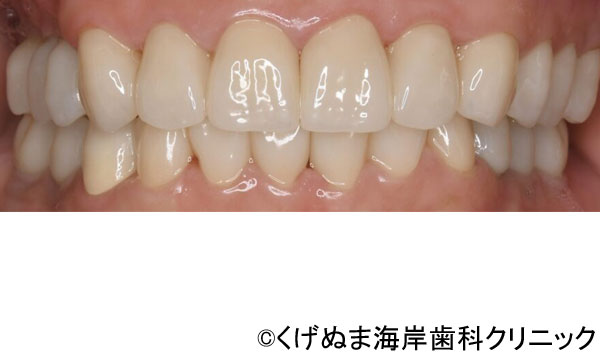 治療後