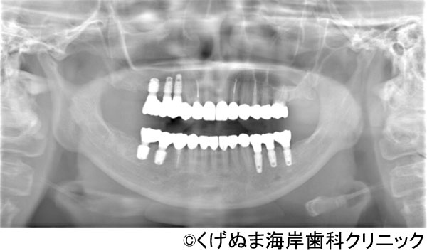 治療後