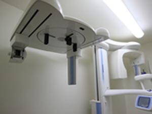 歯科用CT・デジタルレントゲン