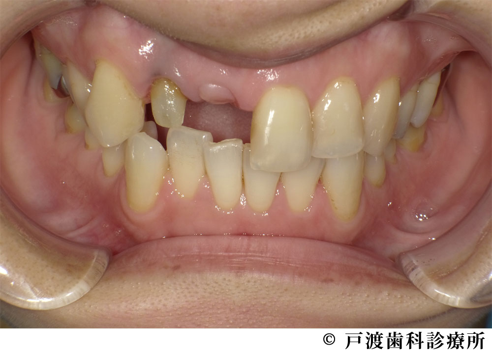 治療前
