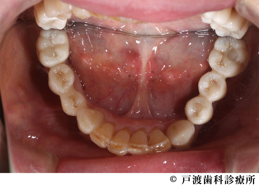 治療後