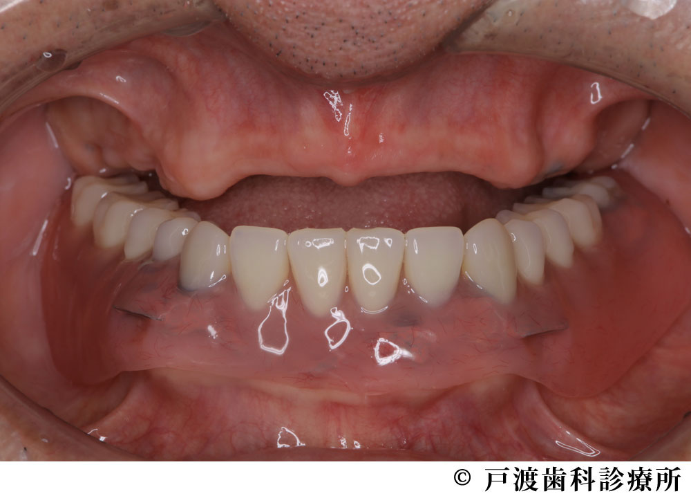 治療前