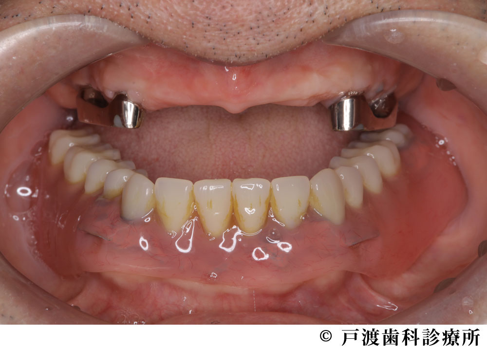 治療中