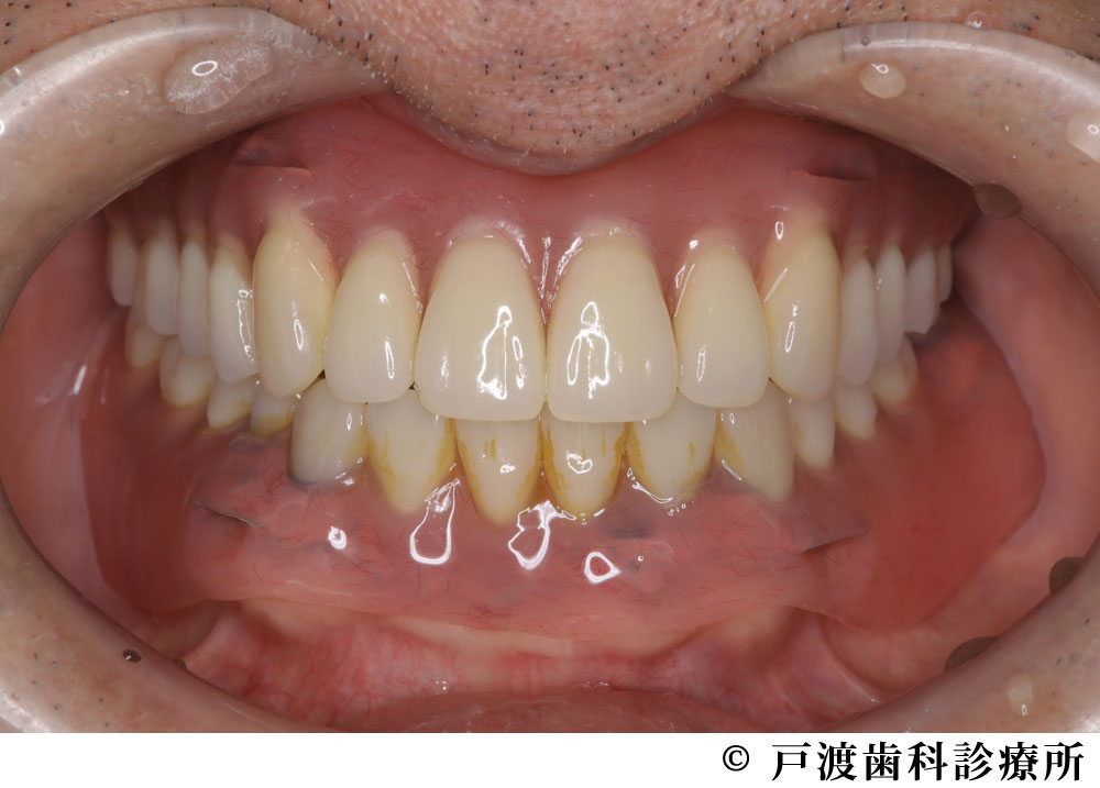治療後