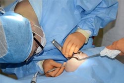 骨の量が足りない場合にも対応