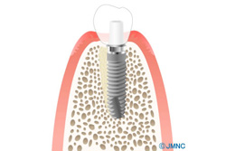 ¨���ٽť���ץ��ȤȤ�