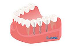 �ڥ���ץ��ȡ�