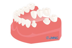 �ڥ֥�å���