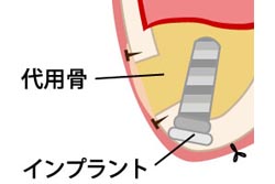 ¡Ú¥µ¥¤¥Ê¥¹¥ê¥Õ¥È¡Û