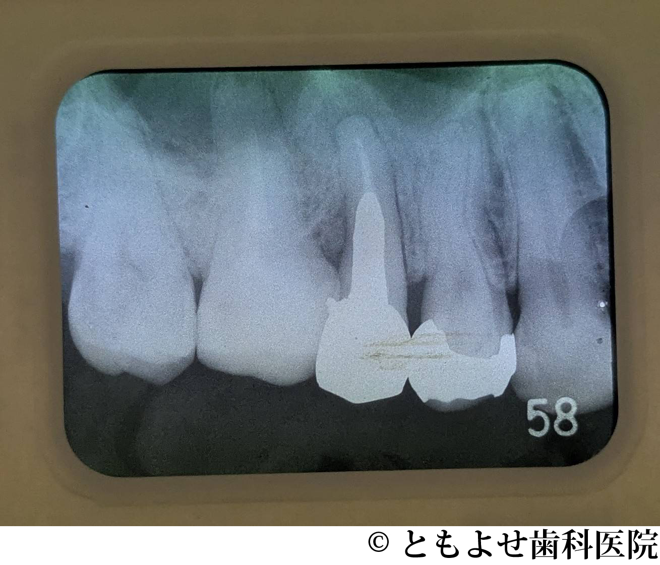 治療前