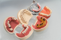 ��ħ1��ưŪ�ʥӥ�������󥷥��ƥ�ȥ��������륬���ɤ����