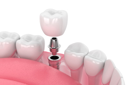 ������¤����