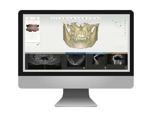 3D���ߥ�졼����󥷥��ƥ�