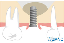 �����åȥ�ե�