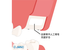 �����ʥ���ե�