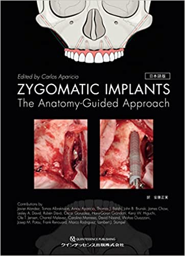 ZYGOMATIC IMPLANTS 日本語版: The Anatomy-Guided Approach