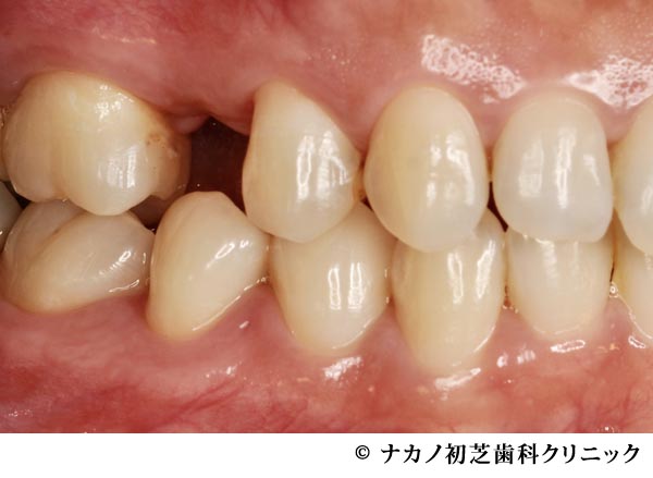 治療前