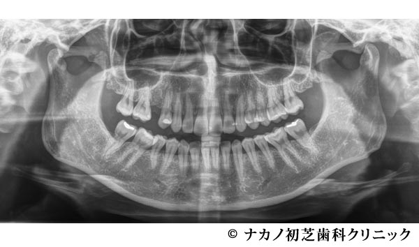 治療前