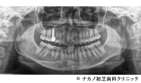 治療後
