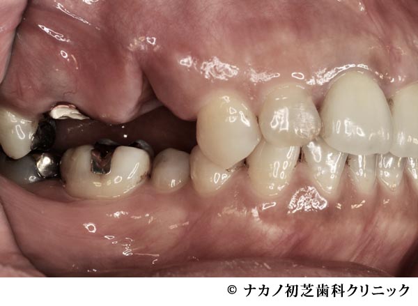 治療前