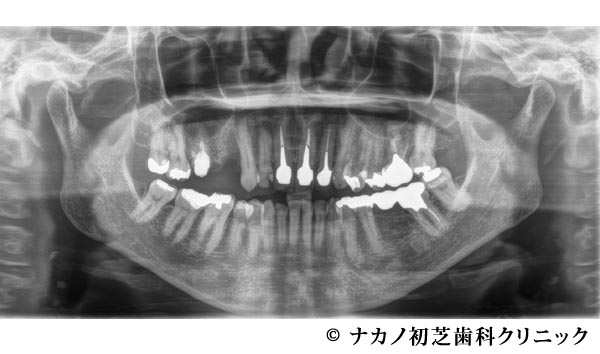 治療前