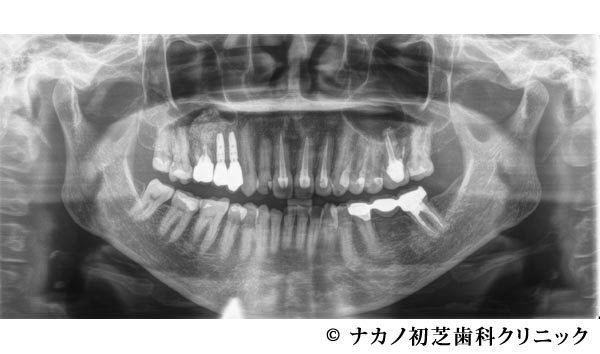 治療後