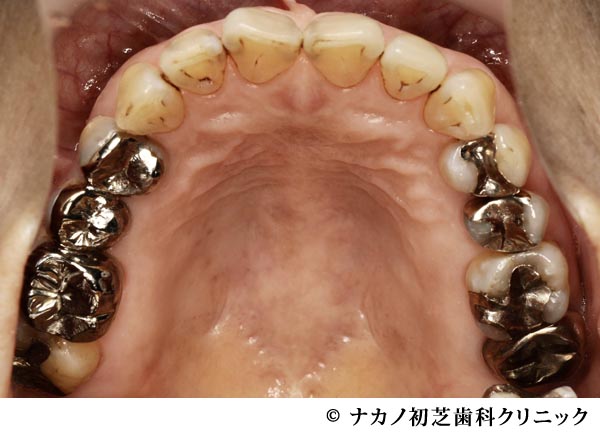 治療前