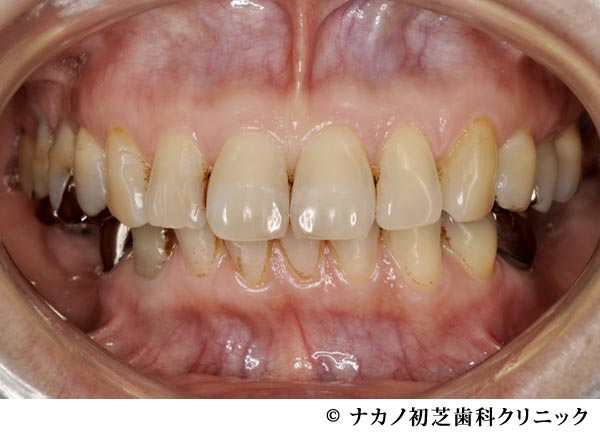 治療前