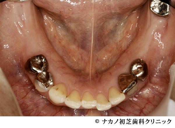 治療前