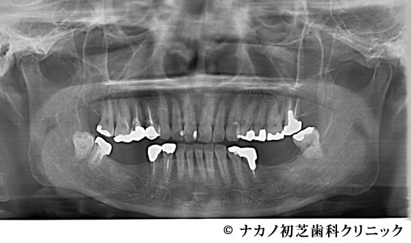治療前