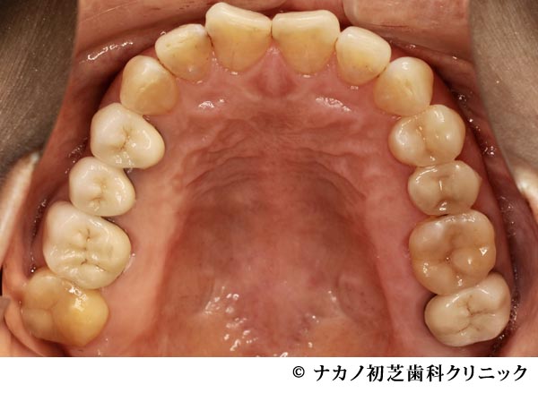 治療後