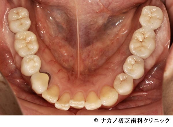 治療後