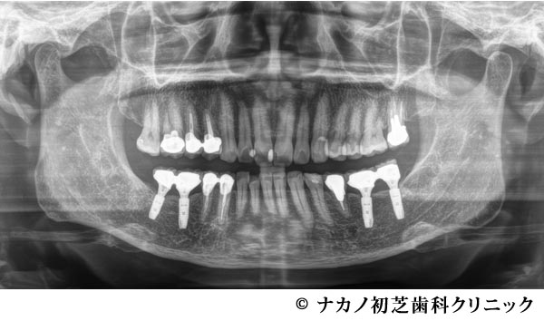 治療後