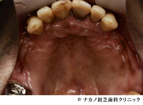 治療前