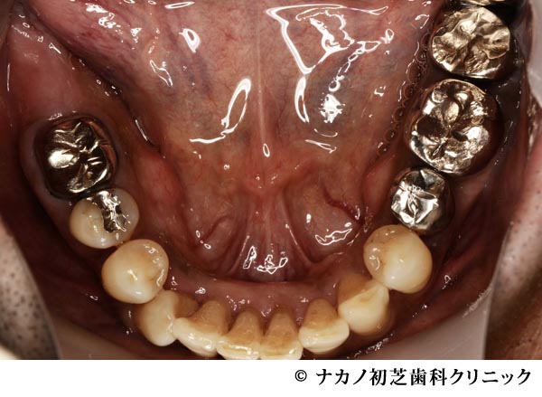 治療前